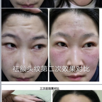 寻梦缘美业 中医美容 针灸微整 技术培训中心